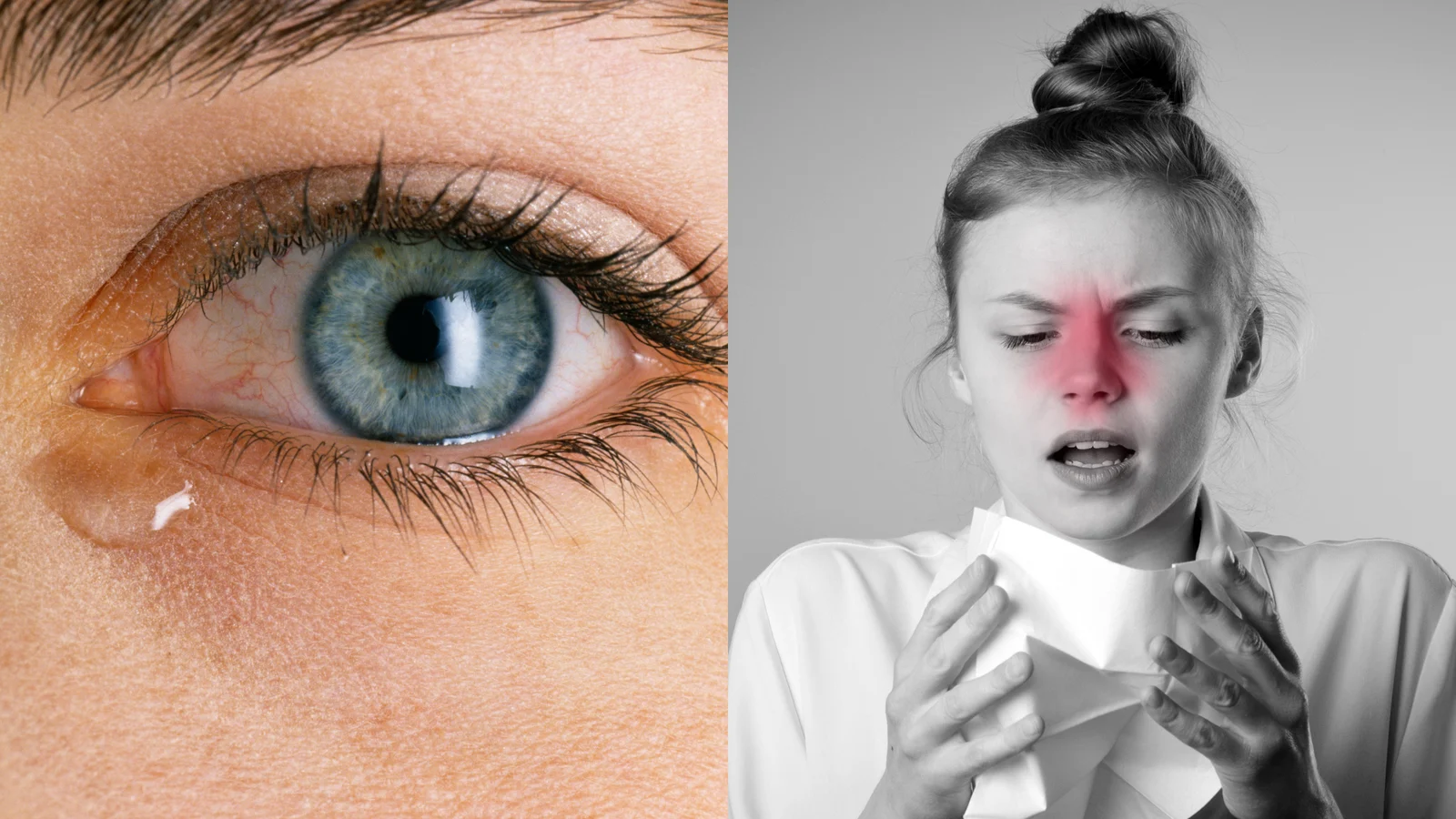 Sluder's Neuralgia Complex: The Hidden Nasal Cause of Chronic Headaches – And How Surgery Can Set You Free